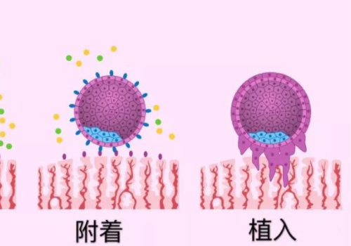 美國試管技術？?